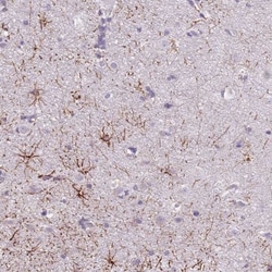SLC35E3 Antibody, Novus Biologicals:Antibodies:Primary Antibodies